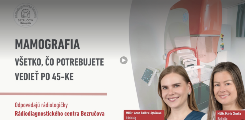 Mamografia: Všetko, čo potrebujete vedieť po 45-ke